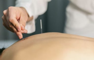 Medicina Tradicional Chinesa