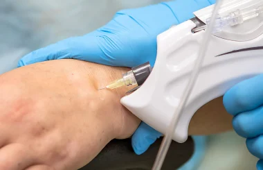 mulher a fazer Ozonoterapia na Tribo Saúde